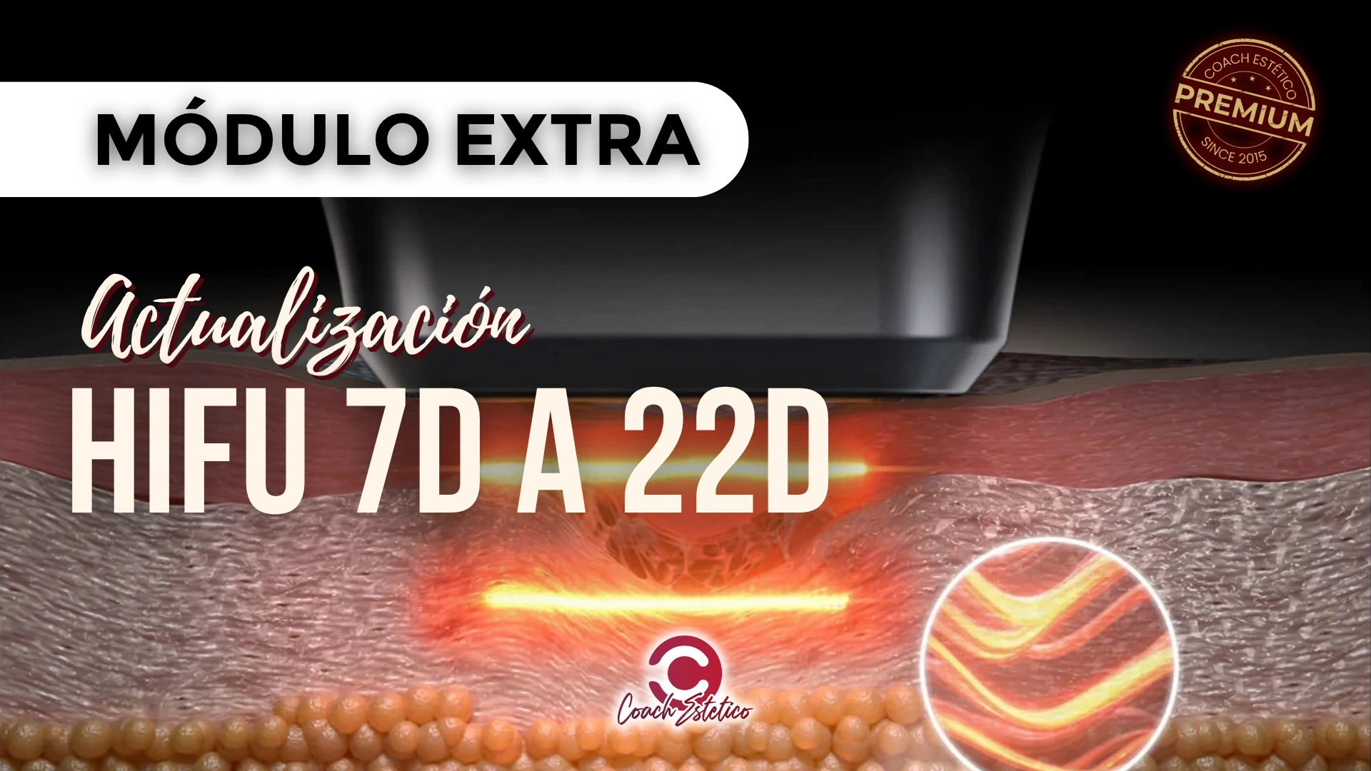 Miniatura Actualización HIFU 7D a 22D